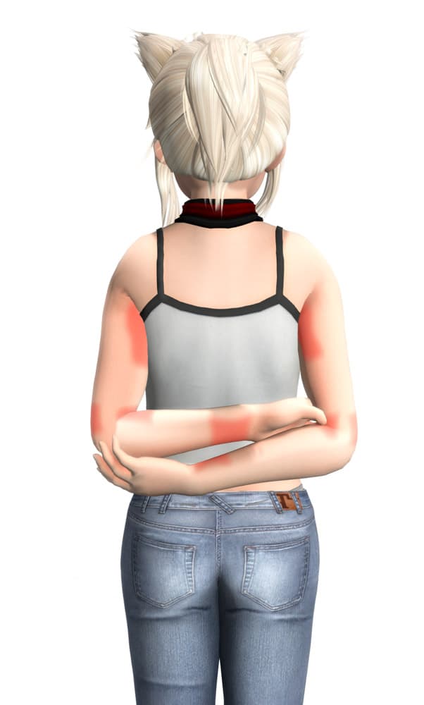 Nerven und Druckpunkte4